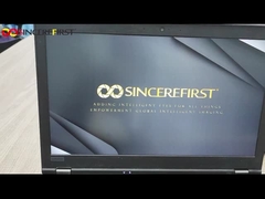 Sony IMX415 Sensor 8MP 4K USB2.0 Kleinkamera Modul